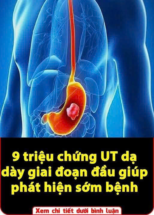 9 triệu chứng UT dạ dày giai đoạn đầu giúp phát hiện sớm bệnh
