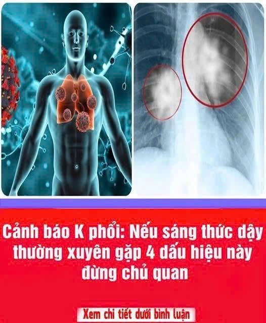 Nếu sáng thức dậy thường xuyên gặp 4 dấu hiệu này, đừng chủ quan